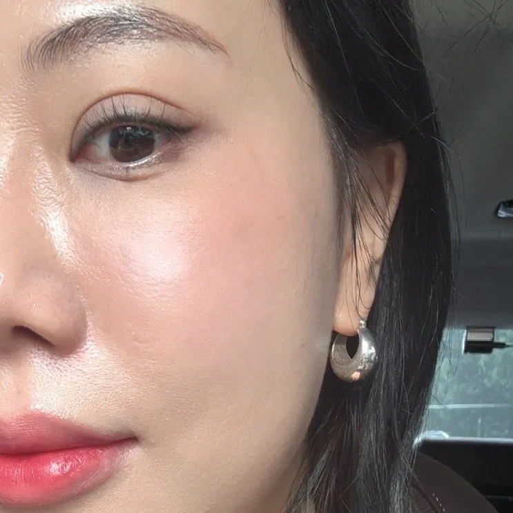 Under-Eye Hollow Lifting Review: Sinnonhyeon Dermatology Eye Wrinkle Package Results