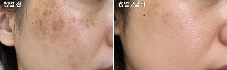 컨실러 없이 기미 커버? 릴시아세럼파데 내돈내산ㅣ찐사용 후기